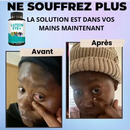 LUTEIN EYE+ – Formule avancée pour vos yeux